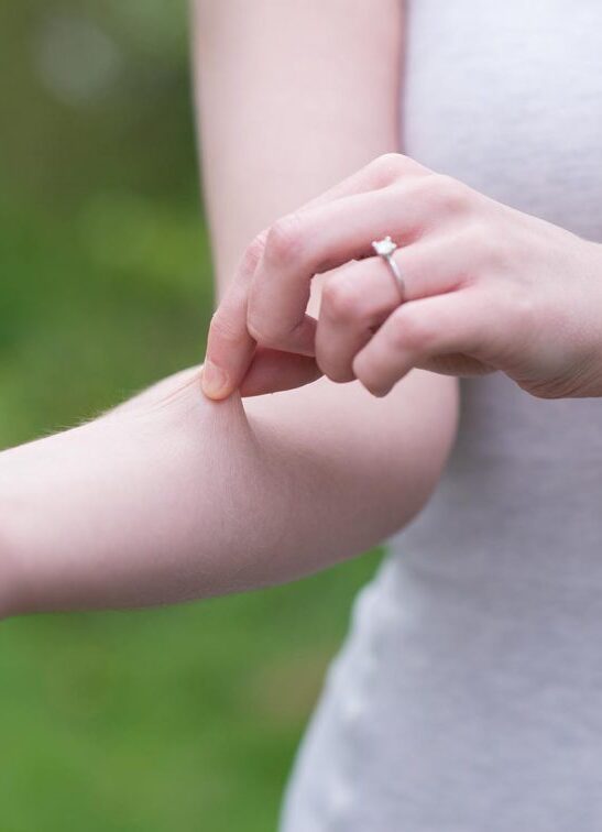 A woman holding her arm with a wedding ring on it.