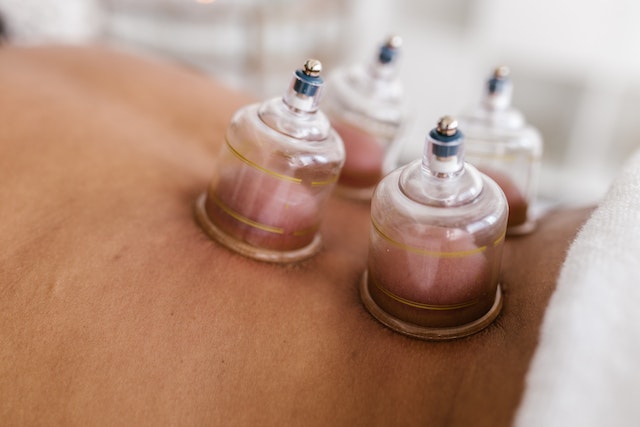 A person is getting an acupuncture treatment.